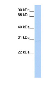 KCNIP2 / KCHIP2 antibody LS-C110044 Western blot of HeLa lysate.