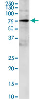 GRB10 monoclonal antibody (M01), clone 1A7. Western Blot analysis of GRB10 expression in IMR-32.