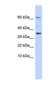 KCNIP2 / KCHIP2 antibody LS-C110048 Western blot of Fetal Liver lysate.