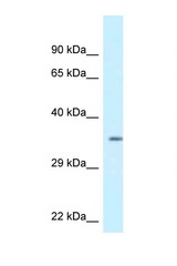 KCNIP2 / KCHIP2 antibody LS-C145483 Western blot of 293T Cell lysate. Antibody concentration 1 ug/ml.