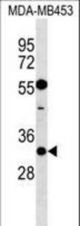 KCNIP2 Antibody western blot of MDA-MB453 cell line lysates (35 ug/lane). The KCNIP2 antibody detected the KCNIP2 protein (arrow).