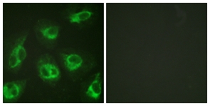 Immunofluorescence of HeLa cells, using Calsenilin/KCNIP3 antibody. The picture on the right is treated with the synthesized peptide.