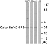 Western blot of extracts from MCF-7/Jurkat/A549 cells, using Calsenilin/KCNIP3 antibody. The lane on the right is treated with the synthesized peptide.