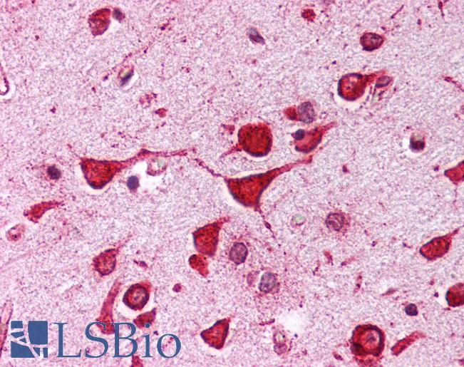 Anti-KCNIP3 / CSEN antibody IHC of human brain, cortex. Immunohistochemistry of formalin-fixed, paraffin-embedded tissue after heat-induced antigen retrieval. Antibody LS-B249 concentration 5 ug/ml.