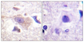 IHC of paraffin-embedded human brain tissue, using GRB10 (Ab-67) Antibody. The picture on the right is treated with the synthesized peptide.
