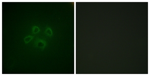 Immunofluorescence of HepG2 cells, using GRB10 (Ab-67) Antibody. The picture on the right is treated with the synthesized peptide.