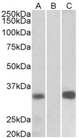 KCNIP3 antibody HEK293 lysate (10 ug protein in RIPA buffer) overexpressing Human KCNIP3 with C-terminal MYC tag probed with (1 ug/ml) in Lane A and probed with anti-MYC Tag (1/1000) in lane C. Mock-transfected HEK293 probed with (1 mg/ml) in Lane B. Primary incubations were for 1 hour. Detected by chemiluminescence.