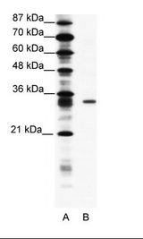 A: Marker, B: Jurkat Cell Lysate