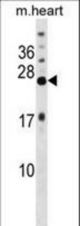 KCNIP4 Antibody western blot of mouse heart tissue lysates (35 ug/lane). The KCNIP4 antibody detected the KCNIP4 protein (arrow).
