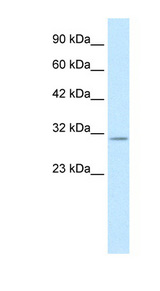 KCNIP4 antibody LS-B977 Western blot of Jurkat lysate.
