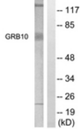 Western blot of extracts from NIH-3T3 cells, treated with Insulin 0.01U/ml 15', using GRB10 (Ab-67) Antibody. The lane on the right is treated with the synthesized peptide.