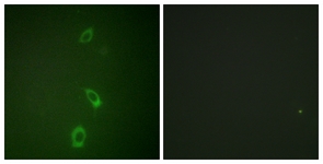 Immunofluorescence of A549 cells, using ROMK/Kir1.1 (Ab-44/25) Antibody. The picture on the right is treated with the synthesized peptide.
