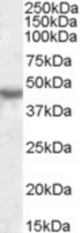 KCNJ1 antibody (1 ug/ml) staining of Human Kidney lysate (35 ug protein/ml in RIPA buffer). Primary incubation was 1 hour. Detected by chemiluminescence.