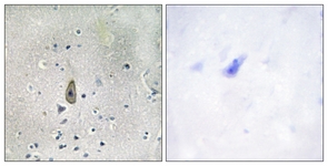 IHC of paraffin-embedded human brain, using ROMK/Kir1.1 (Phospho-Ser44/25) Antibody. The sample on the right was incubated with synthetic peptide.