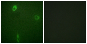 Immunofluorescence of A549 cells, using ROMK/Kir1.1 (Phospho-Ser44/25) Antibody. The sample on the right was incubated with synthetic peptide.
