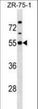 KCNJ1 Antibody western blot of ZR-75-1 cell line lysates (35 ug/lane). The KCNJ1 antibody detected the KCNJ1 protein (arrow).