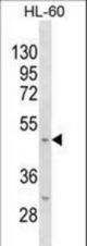 Mouse Kcnj11 Antibody western blot of HL-60 cell line lysates (35 ug/lane). The Mouse Kcnj11 antibody detected the Mouse Kcnj11 protein (arrow).