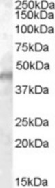 Antibody (0.01 ug/ml) staining of Human Muscle lysate (35 ug protein in RIPA buffer). Primary incubation was 1 hour. Detected by chemiluminescence.