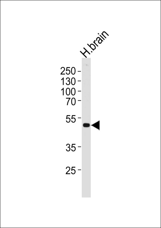 Western blot of lysate from human brain tissue lysate, using KCNJ12 Antibody. Antibody was diluted at 1:1000 at each lane. A goat anti-rabbit IgG H&L (HRP) at 1:5000 dilution was used as the secondary antibody. Lysate at 35ug per lane.