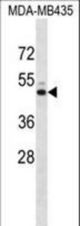 KCNJ13 Antibody western blot of MDA-MB435 cell line lysates (35 ug/lane). The KCNJ13 antibody detected the KCNJ13 protein (arrow).