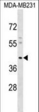 KCNJ15 Antibody western blot of MDA-MB231 cell line lysates (35 ug/lane). The KCNJ15 antibody detected the KCNJ15 protein (arrow).