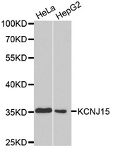 Western blot analysis of extracts of various cell lines, using KCNJ15 antibody.