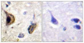 IHC of paraffin-embedded human brain, using Kir5.1 (Phospho-Ser417) Antibody. The sample on the right was incubated with synthetic peptide.