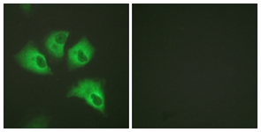 Immunofluorescence of HeLa cells, using Kir5.1 (Phospho-Ser417) Antibody. The sample on the right was incubated with synthetic peptide.