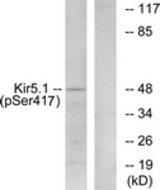 Western blot of extracts from RAW264.7 cells treated with forskolin 40nM 30', using Kir5.1 (Phospho-Ser417) Antibody. The lane on the right was incubated with synthetic peptide.