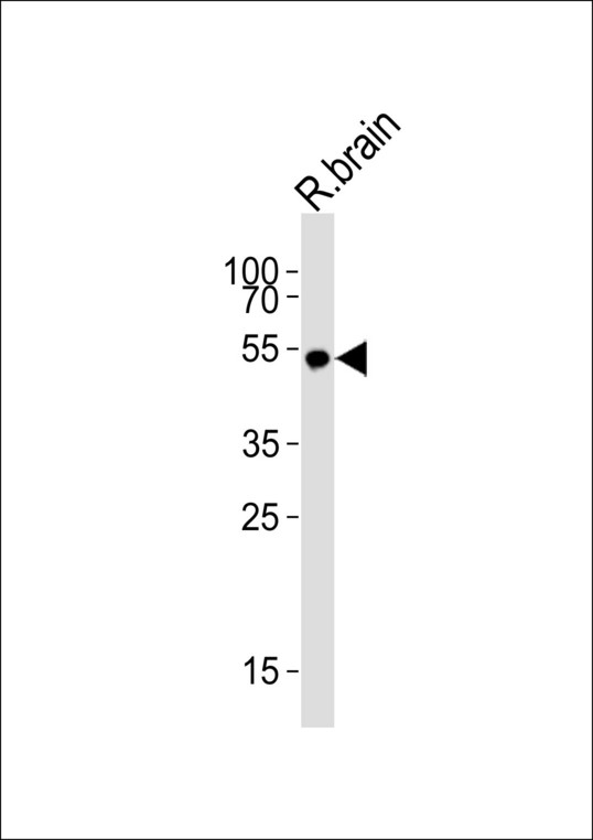 Western blot of lysate from rat brain tissue lysate with KCNJ16 Antibody. Antibody was diluted at 1:1000. A goat anti-rabbit IgG H&L (HRP) at 1:10000 dilution was used as the secondary antibody. Lysate at 35 ug.