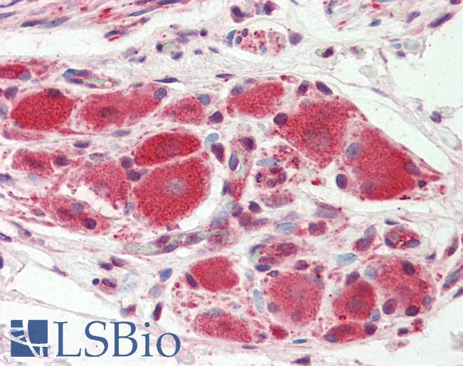 Anti-KCNJ16 / KIR5.1 antibody IHC staining of human ganglion cells (prostate). Immunohistochemistry of formalin-fixed, paraffin-embedded tissue after heat-induced antigen retrieval. Antibody LS-B9865 concentration 20 ug/ml.