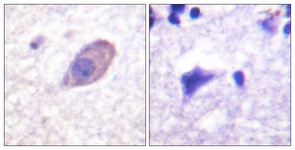 IHC of paraffin-embedded human brain tissue, using Kir5.1 Antibody. The picture on the right is treated with the synthesized peptide.