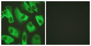 Immunofluorescence of HeLa cells, using Kir5.1 Antibody. The picture on the right is treated with the synthesized peptide.