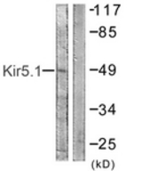 Western blot of extracts from HeLa cells, using Kir5.1 Antibody. The lane on the right is treated with the synthesized peptide.