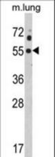 Western blot of KCNJ2 Antibody in mouse lung tissue lysates (35 ug/lane). KCNJ2 (arrow) was detected using the purified antibody.