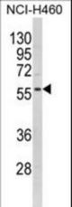 Western blot of KCNJ2 Antibody in NCI-H460 cell line lysates (35 ug/lane). KCNJ2 (arrow) was detected using the purified antibody.