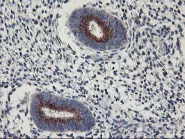 IHC of paraffin-embedded Human endometrium tissue using anti-KCNJ3 mouse monoclonal antibody.