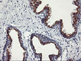 IHC of paraffin-embedded Human prostate tissue using anti-KCNJ3 mouse monoclonal antibody.