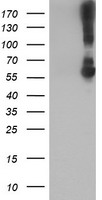 HEK293T cells were transfected with the pCMV6-ENTRY control (Left lane) or pCMV6-ENTRY KCNJ3 (Right lane) cDNA for 48 hrs and lysed. Equivalent amounts of cell lysates (5 ug per lane) were separated by SDS-PAGE and immunoblotted with anti-KCNJ3.