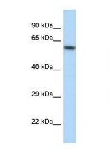 KCNJ3 / Kir3.1 antibody LS-C145543 Western blot of Mouse Kidney lysate. Antibody concentration 1 ug/ml.