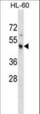 KCNJ3 Antibody western blot of HL-60 cell line lysates (35 ug/lane). The KCNJ3 antibody detected the KCNJ3 protein (arrow).