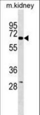 KCNJ3 Antibody western blot of mouse kidney tissue lysates (35 ug/lane). The KCNJ3 antibody detected the KCNJ3 protein (arrow).