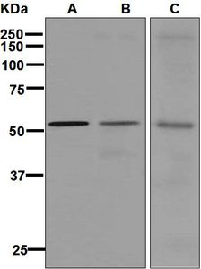 Western blot analysis on (A) HeLa, (B) fetal heart, and (C) NIH/3T3 lysates using anti-GIRK1 antibody.