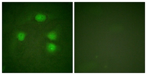 Immunofluorescence of HeLa cells, using GIRK1/KIR3.1/KCNJ3 (Ab-185) Antibody. The picture on the right is treated with the synthesized peptide.