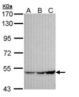 Sample (30 ug of whole cell lysate). A: A431 , B: H1299, C: Hela. 7.5% SDS PAGE. KCNJ3 / GIRK1 antibody diluted at 1:1000.