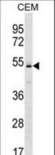 KCNJ4 Antibody western blot of CEM cell line lysates (35 ug/lane). The KCNJ4 antibody detected the KCNJ4 protein (arrow).