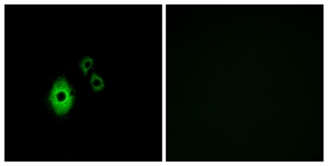 Immunofluorescence of A549 cells, using KCNJ5 Antibody. The picture on the right is treated with the synthesized peptide.