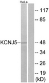 Western blot of extracts from HeLa cells, using KCNJ5 Antibody. The lane on the right is treated with the synthesized peptide.