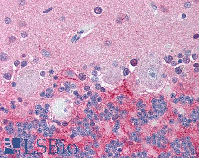 Anti-KCNJ6 / GIRK2 antibody LS-A9571 IHC of human brain, cerebellum. Immunohistochemistry of formalin-fixed, paraffin-embedded tissue after heat-induced antigen retrieval.
