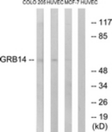 Western blot of extracts from HUVEC/COLO/MCF-7 cells, using GRB14 Antibody. The lane on the right is treated with the synthesized peptide.